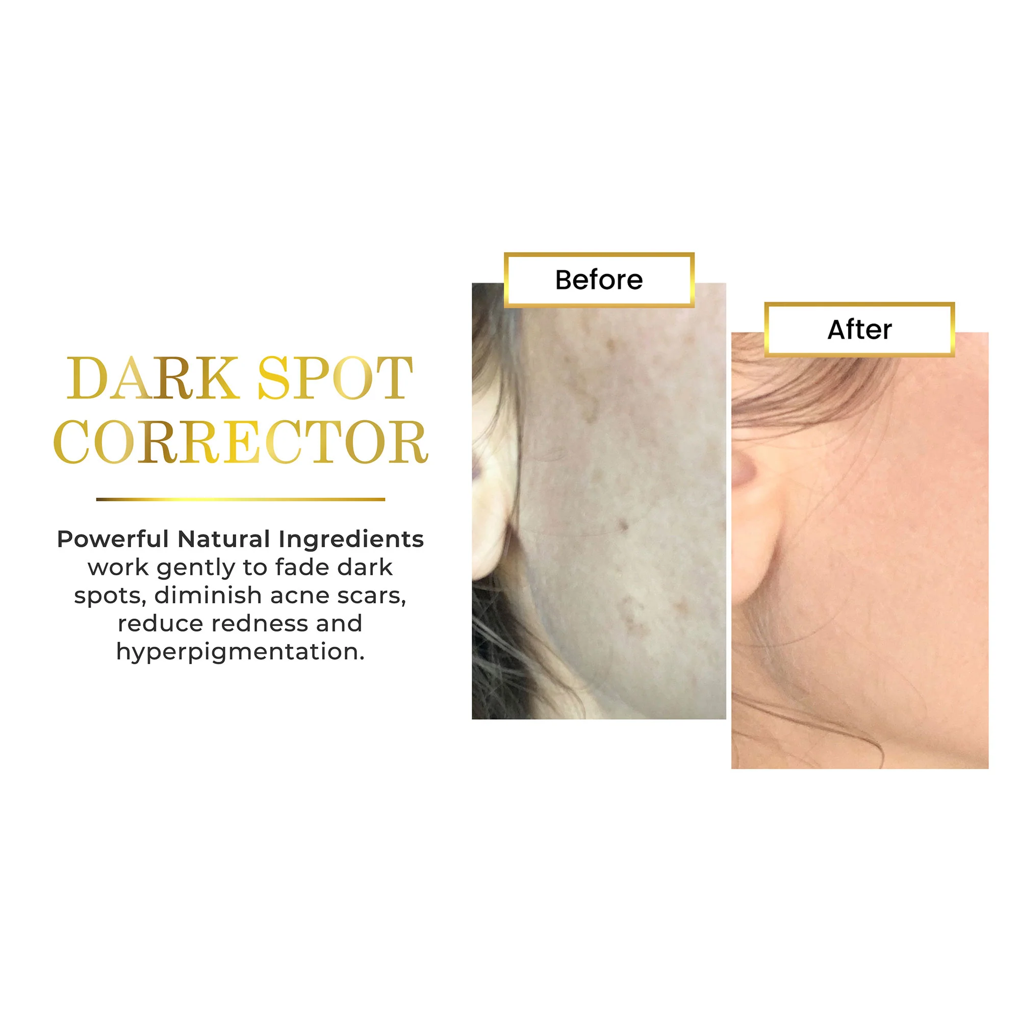 Lightening Serum - Image 4