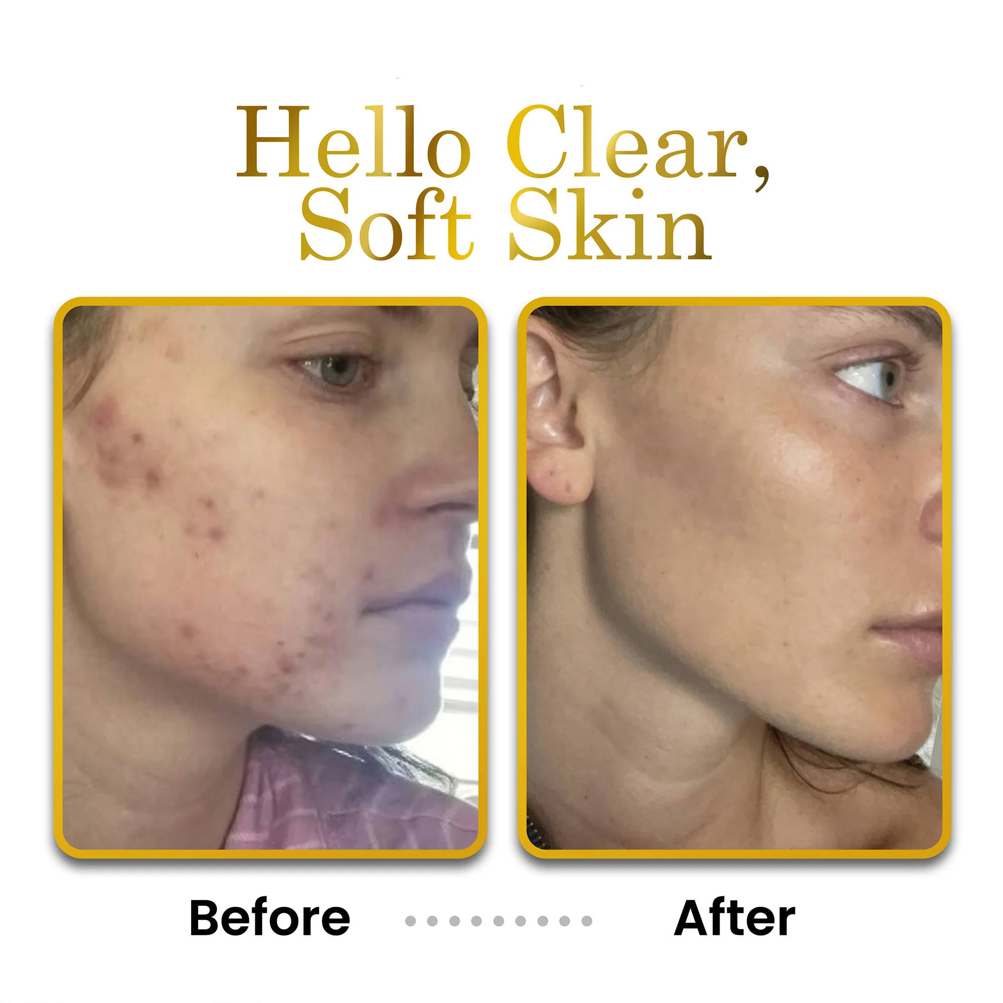 Face Moisturizer - 2 oz Unscented - Image 4